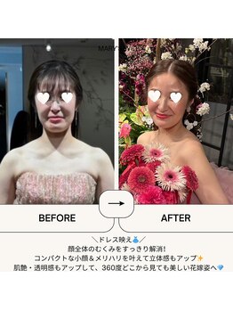 マリーズウィル(MARY's WILL)の写真/挙式当日に最高峰の美しさを。オールハンド全身調律矯正で叶える、引き締まった小顔と極上の肌艶