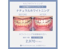 プラチナムビューティー 大分中津店