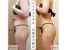 レイプラス イオン卸町店(RAY PLUS)/◆ビフォーアフター例のご紹介◆