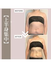 ミックスアップ 池袋店(Mix up!!)/【お腹周り集中】