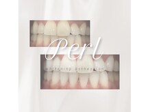 ペルレ(Perl)