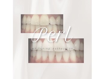 ペルレ(Perl)