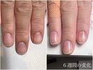 自爪育成/深爪育成/ネイルケア