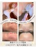 【美容クリニック監修】毛穴の大掃除　ニキビケア！　お試し価格￥5,800