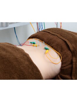 鍼灸施術を受けたい