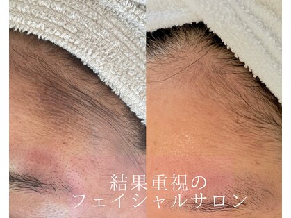 サラシック(salachic)の写真