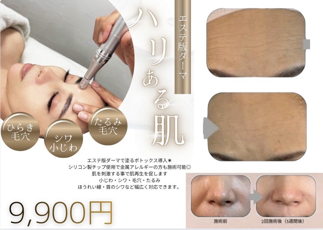 大阪上本町駅で毛穴洗浄・毛穴吸引が人気のエステサロン