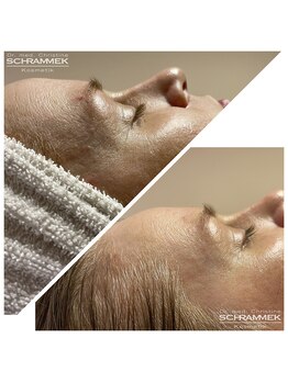 オリエンタルグリーン 銀座(ORIENTAL GREEN)/グリーンピール