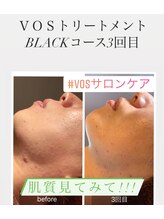 ラヴィエール(Laviere)/VOS BLACK