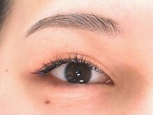 チェリーアイ(cherry eye)