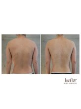 サプナジー(Suppnrgy)/カスタムトリートメント