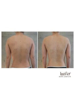 サプナジー(Suppnrgy)/カスタムトリートメント