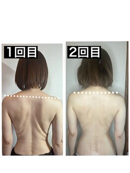 ハーズプラス(hers+)/背中も変わります