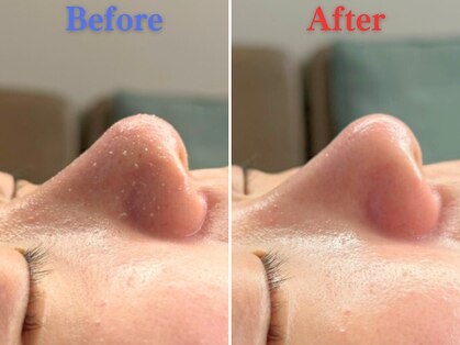 ボーンオム(Born Homme)の写真