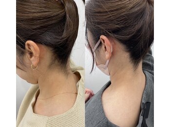 ミース 長野店/うなじ矯正◆ビフォーアフター