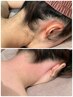 【wax脱毛+光脱毛】うなじ脱毛 / 夏に向けて！イベント前にも◎うなじ美人♪