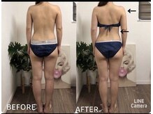 ミリミリ(mili mili)/全身施術