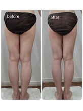 レスプロンディール(Resplendir)/美脚ライン☆