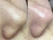 リッカロッカ(RIKKA&ROCCA)/衝撃と感動のBefore・After