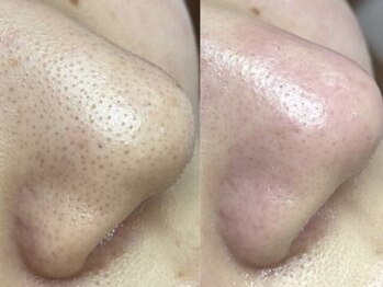 リッカロッカ(RIKKA&ROCCA)/衝撃と感動のBefore・After