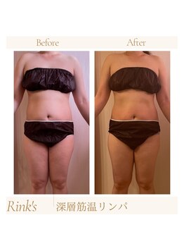 リンクス(Rink's)/before→after