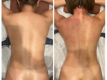 スピード美人 柏店/4回施術でこの変化