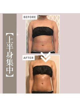 ミックスアップ 池袋店(Mix up!!)/【お腹周り集中】