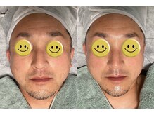 ホワイティアビシェル 浦和(Whitia Vishell)/浦和小顔Vライン専門