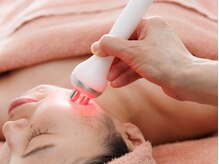 ライラ(Lyra)の雰囲気（スターテック/フェイシャル/小顔）