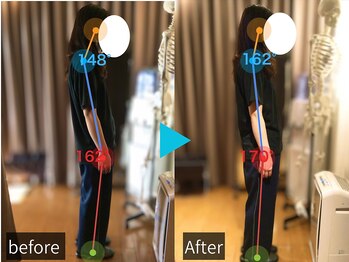 カラダケア 札幌大通店/◆骨盤ケア Before-After