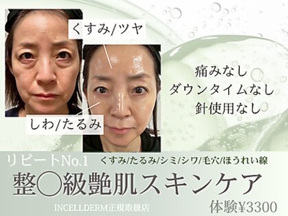 ヴィディトゥ(vidyto)の写真