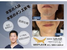 ジェントル 三宮