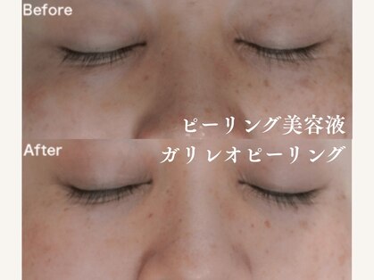 ティアラ(TIARA)の写真
