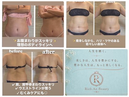 リッチアンビューティー(Rich.an beauty)の写真