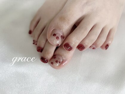 グレイス(grace)の写真