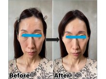 整顔院 学芸大学店/