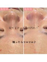 エクラ アン(eclat.un)/20代女性：ダブル導入