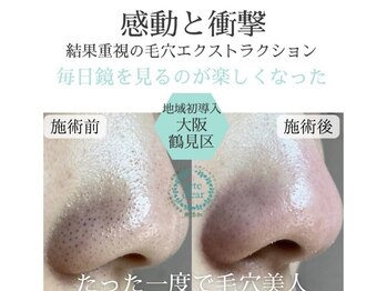 リッカロッカ(RIKKA&ROCCA)/衝撃と感動のBefore・After