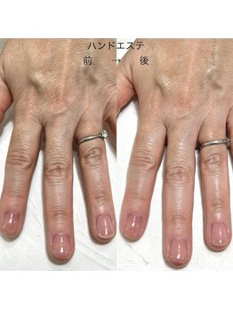 リンク(LINK)/ハンドエステ