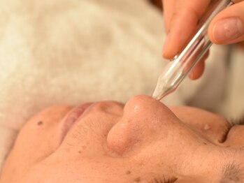 風花/自分ではケアできない深層から