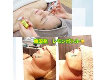 ボディスタイリング(Body Styling)の雰囲気（韓国初！脂肪分解レモンボトルでお顔のたるみを解決）