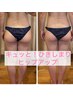 【下半身太りをリセット】骨盤矯正×もも裏＆お尻リンパ集中ケア60分 ¥7,700