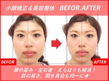 豊中吹田美容整体リジョイス