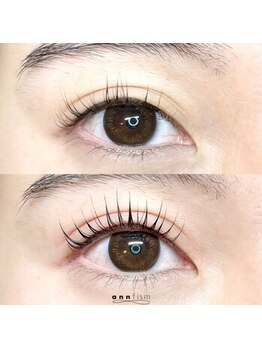 アンフィズム(annfism)/