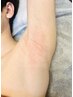 【男性用クーポン】5月5名様限定！脇ワックス脱毛 /メンズ脱毛/両ワキ