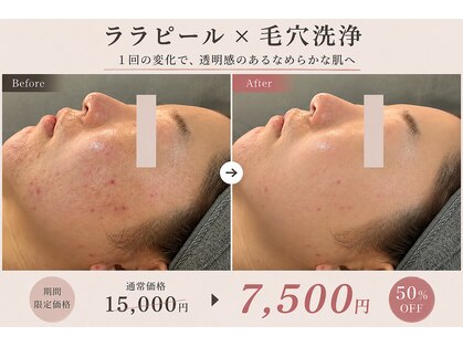 エクロール リ スキン(Eclore_re:skin)の写真