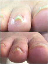 モアクリスタル(More Crystal)/