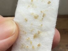 リッカロッカ(RIKKA&ROCCA)/衝撃と感動のBefore・After