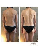 サプナジー(Suppnrgy)/カスタムトリートメント