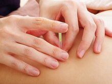 睦庵の雰囲気（鍼で深層にアプローチし全身を調整◎お顔もシワやたるみを改善◎）